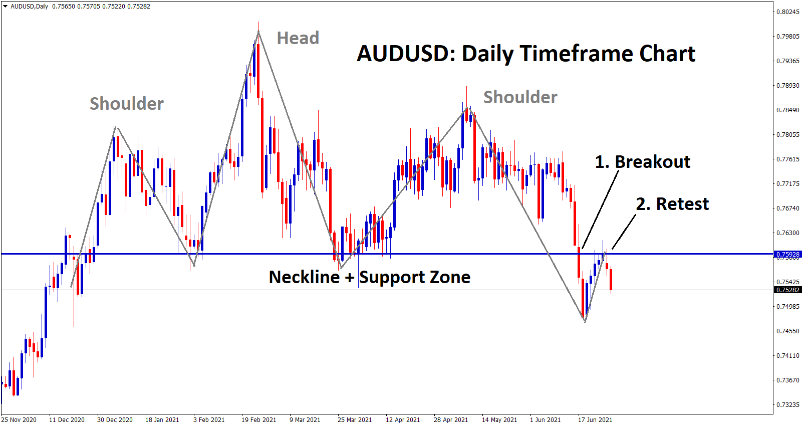 audusd breakout and retest of the support zone and neckline of the HS