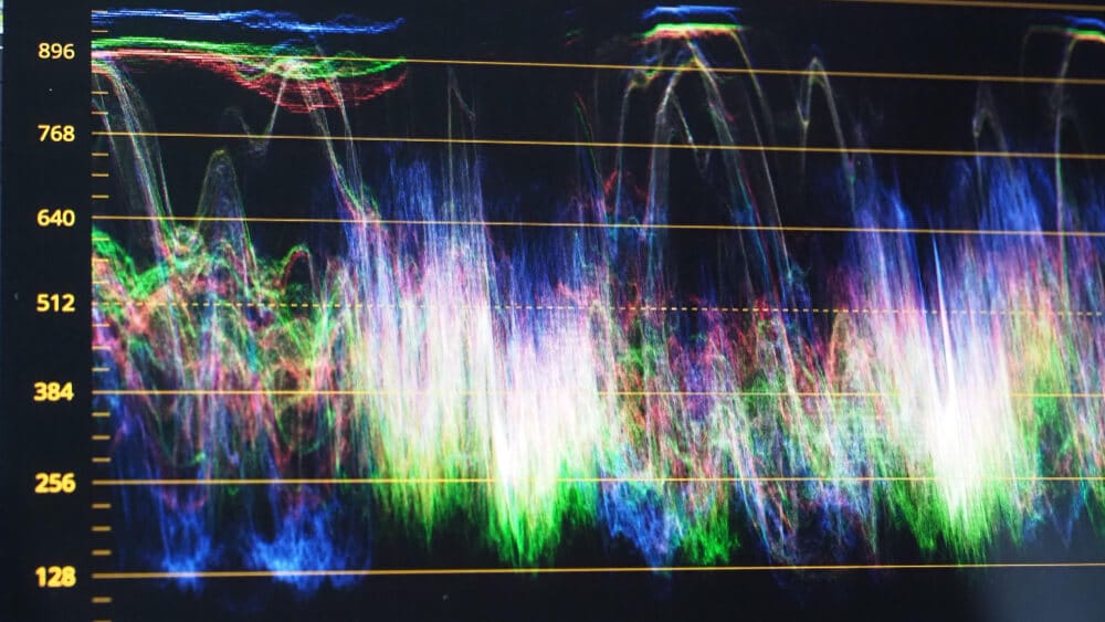 Mixed Signal